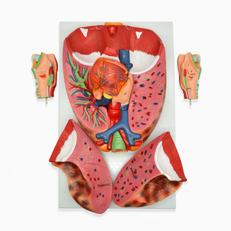 Модель «Система органов дыхания» (модель легких) Модель «Система органов дыхания» (модель легких)